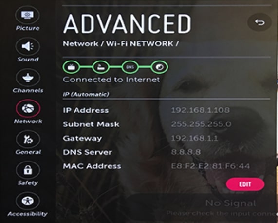 change LG TV DNS